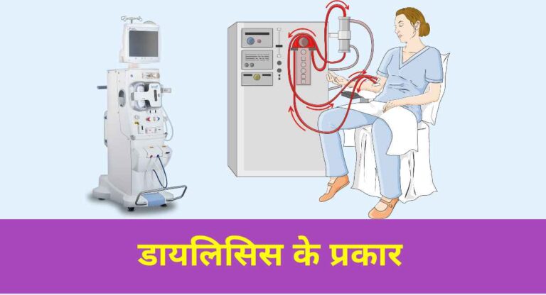 डायलिसिस के प्रकार को जानिए (Dialysis Process In Hindi) 